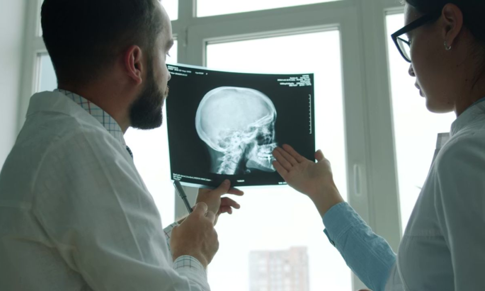 MRI Machine vs. CT Scan