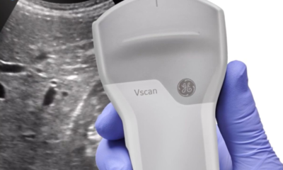 Portable Ultrasound Machines