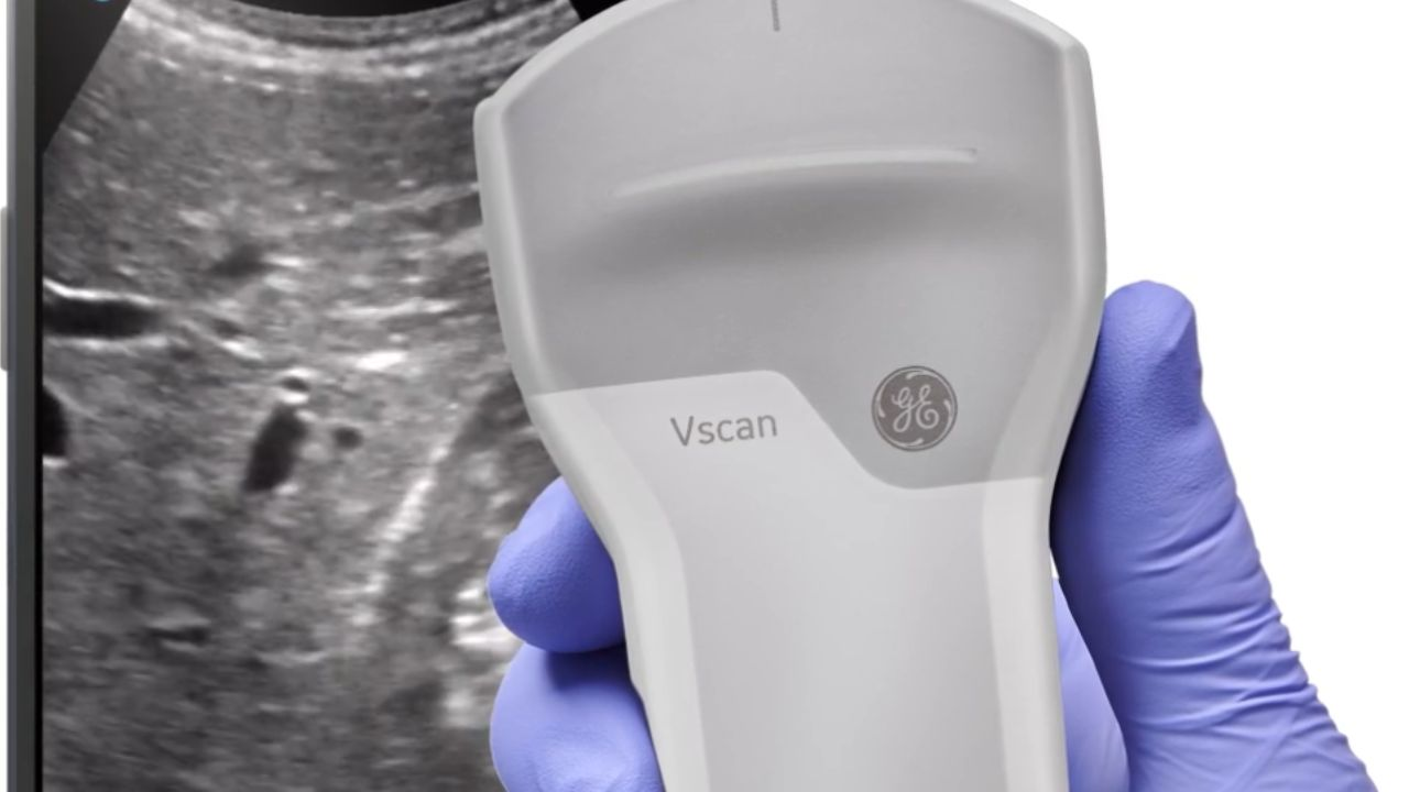 Portable Ultrasound Machines