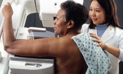 mammography machine