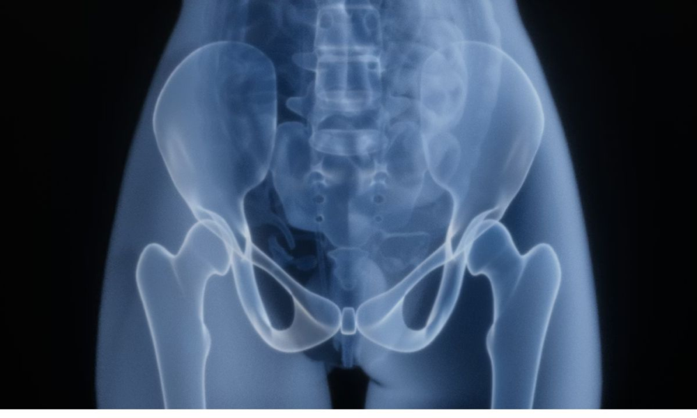 DEXA Bone Density Scanning