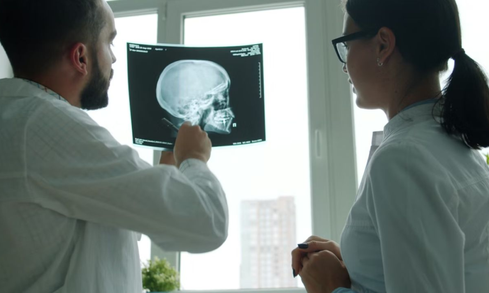 Digital X-ray vs film X-ray