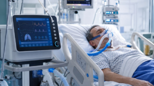 High-end ICU Ventilators