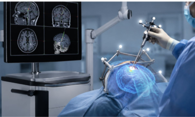 Surgical Navigation Systems