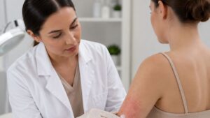dermatological steroid creams